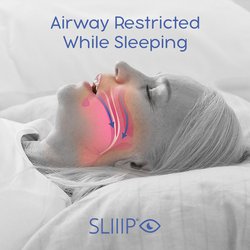 Sleep Apnea and Atrial Fibrillation: Role of the Cardiac Autonomic Nervous System