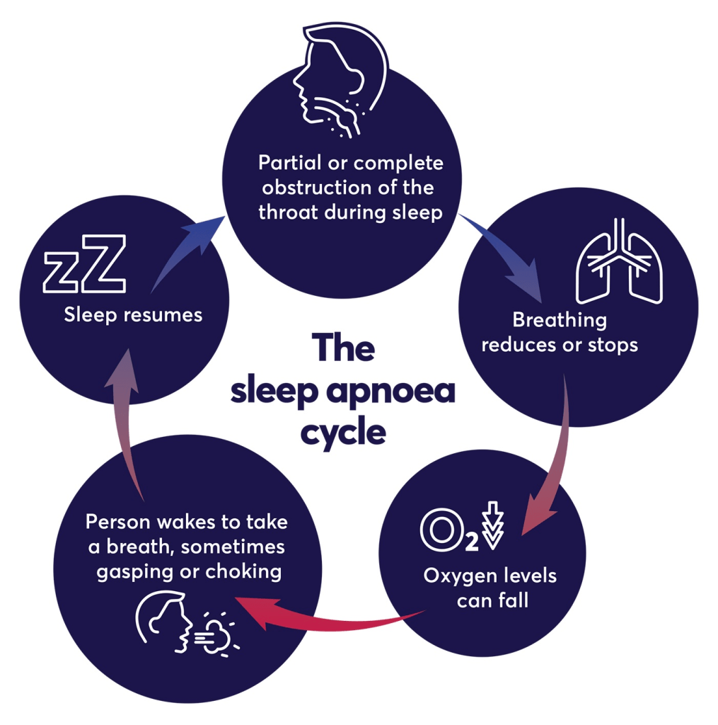 why sleep apnea can kill