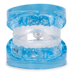 myTAP: Precision Fit Oral Appliance