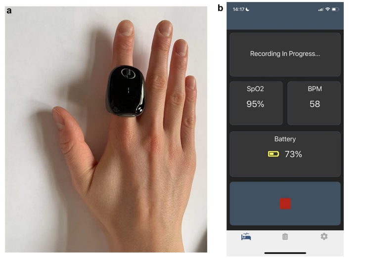 Home sleep test with Sliiip